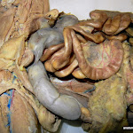 01_uterine.JPG