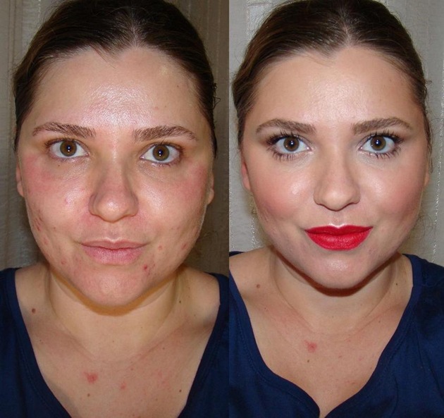 antes depois antes depois