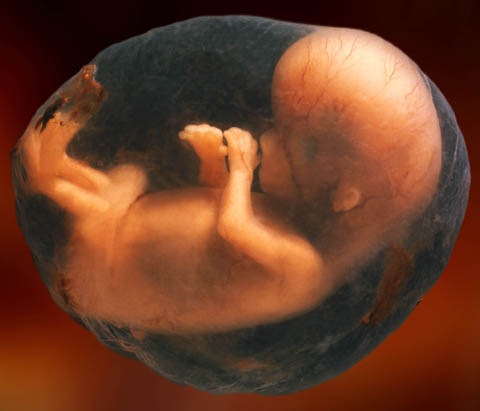 [8-week-unborn-baby%255B4%255D.jpg]