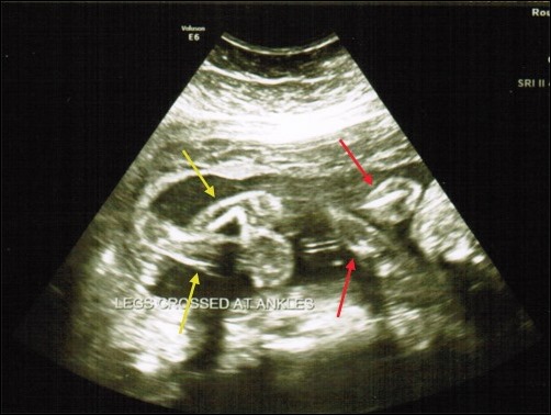 legs and arms ultrasound