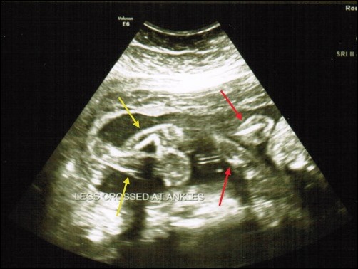 legs and arms ultrasound legs and arms ultrasound