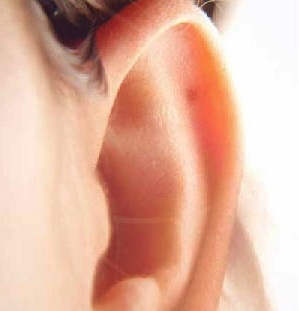 [Ear5.jpg]