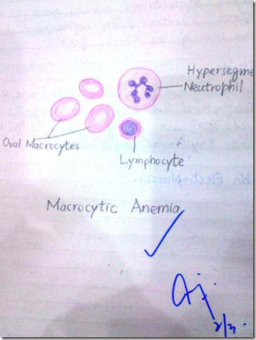 macrocytic anemia diagram histopathology online