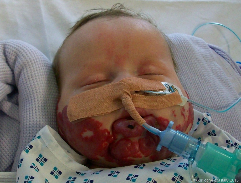 [Ethan%2520in%2520picu%255B2%255D.jpg]
