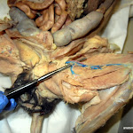femoral_artery_vein.JPG