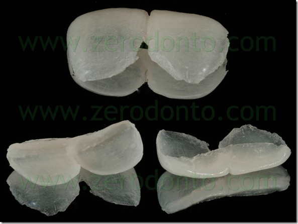20 mockup veneer