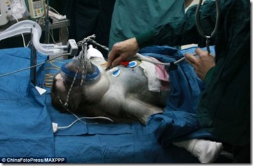 Create-History-On-Monkey-Liver-Surgery-565x370