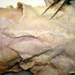 chest_pectoralis_minor.JPG