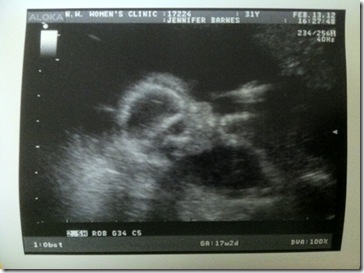 Ultrasound4