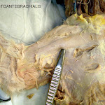 pectoantebrachialis_close_L.jpg