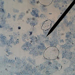 cheek01.jpg