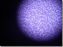 CLL -eoinophilia slide photograph