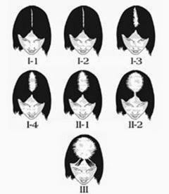 pic-women-hair-loss1
