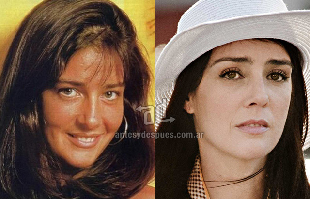 La nueva nariz operada de Paola Krum