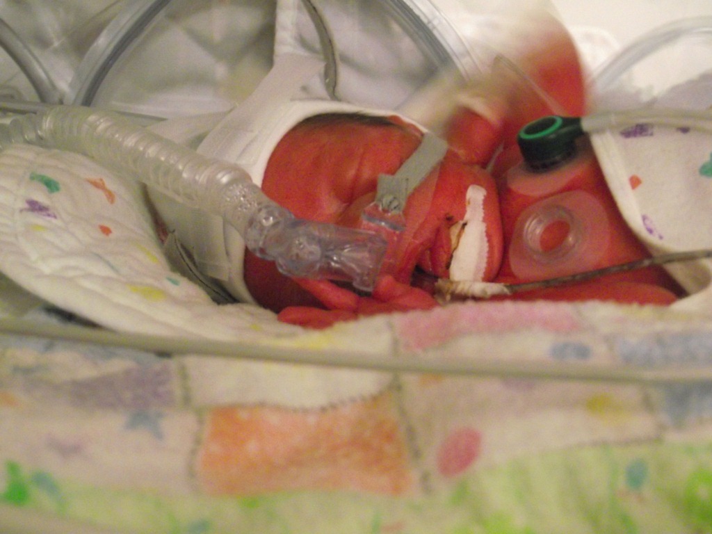 [OurbabiesPic15.jpg]