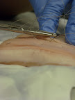 Suturing at UPRAS 2009