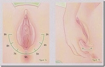 La máscara para la persona el plasma