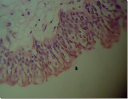Transitional epithelium highly magnified microscopy
