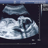 Boy #3