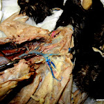 brachiocephalic_vein.JPG