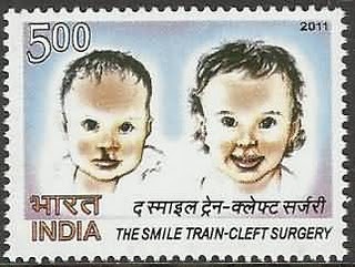 [the-smile-train-cleft-surgery%255B4%255D.jpg]