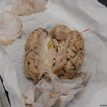 brain_pineal.JPG