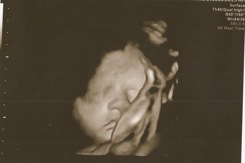 [SCAN0069%255B5%255D.jpg]