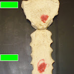 sternum.jpg