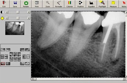 [digital-dental-xrays%255B6%255D.jpg]