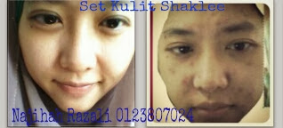 Set Kulit Cantik, Vitamin B, Vitamin E, Vitamin C, ESP, Collagen Powder, kulit cantik berseri, kulit cantik dan glow, kulit cantik tanpa make up, kulit cantik dan sihat, kulit cantik alami, kulit cantik semulajadi, anti-penuaan, kolagen, anjal, kulit anjal, kurang kedutan, awet muda