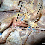 large_intestine_L.JPG