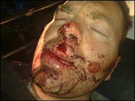 Swart Johan beaten to a pulp Kempton Park Campana PubGrill Aug242011 Sondag