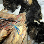 common_carotid_L.JPG
