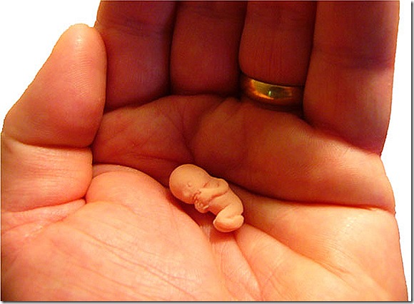 o-drama-do-aborto-espontaneo-53-71-thumb-570