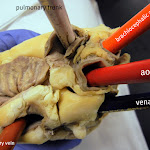heart_vessels_external_closer_labeled.JPG