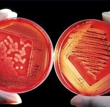 [article-page-main_ehow_images_a05_46_fi_bacteria-life-cycle-800x800%255B3%255D.jpg]