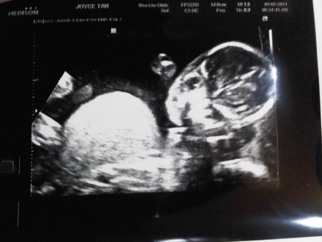 [IMG00460-20110808-2253%255B3%255D.jpg]