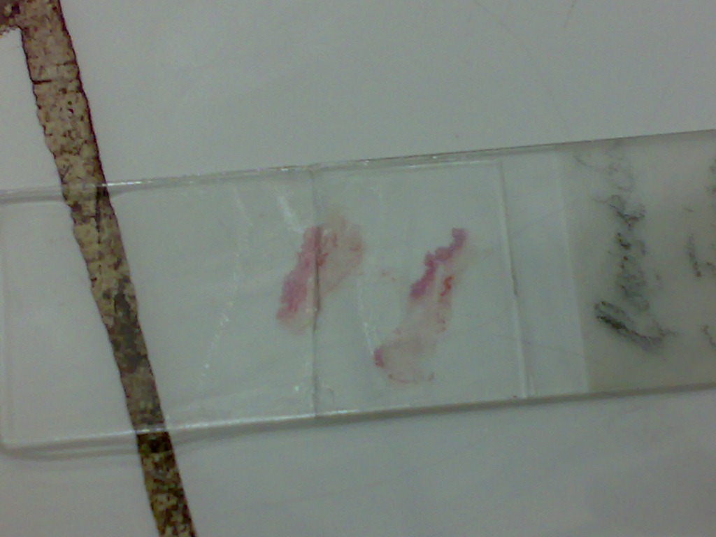 [loose%2520connective%2520tissue%2520staining%2520on%2520glass%2520slide%255B4%255D.jpg]