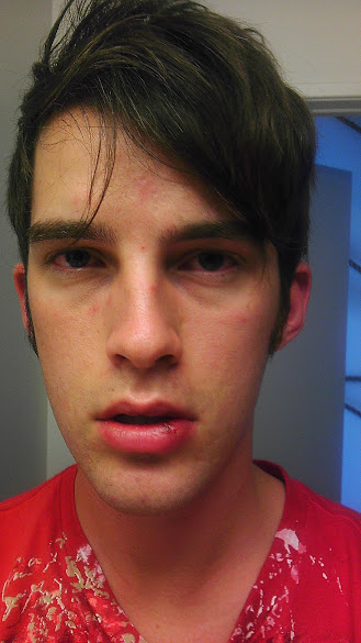 Morning after being punched in the face on the streets of Chicago by Septimiu (Septi) Teodorescu, owner of Septi Fitness on the Wisconsin Capitol Square. He did not like how I publicized the last time he punched me, after which I called the police. Oh, and he is about 44 and extremely muscular. Hmm. IMAG0010.jpg