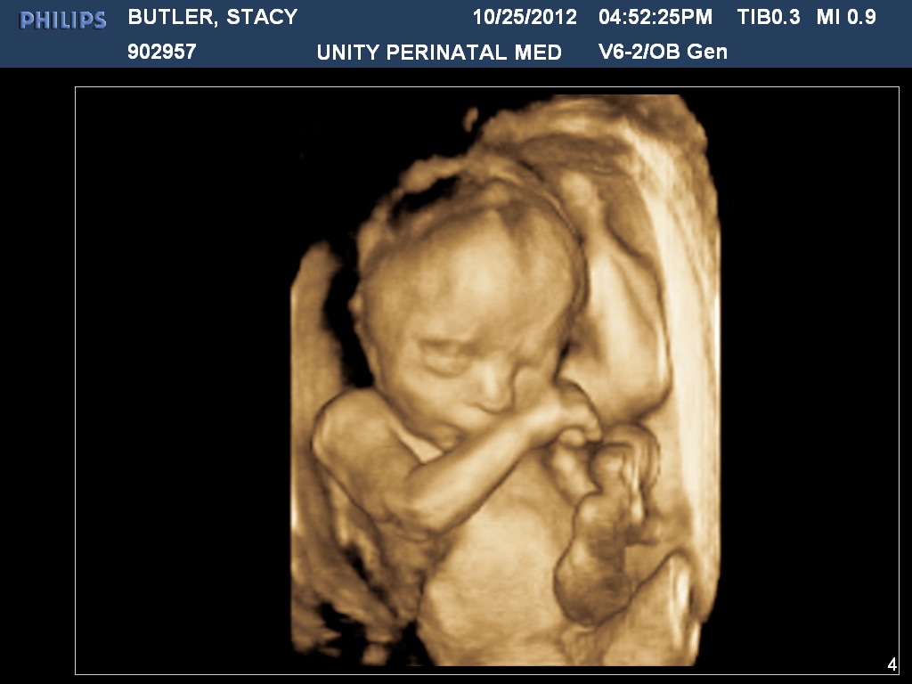 [BUTLERSTACY20121025165226438%255B5%255D.jpg]