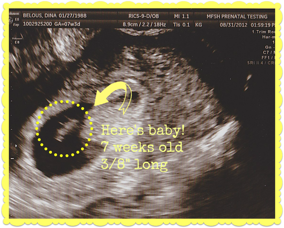 [8.31.12%2520-%25207%2520Weeks%255B4%255D.png]