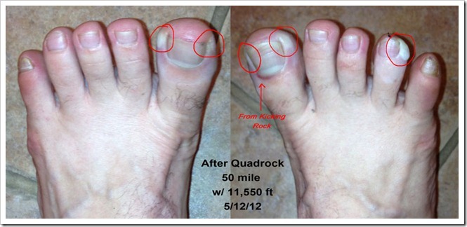 [my-Feet_thumb%255B7%255D%255B6%255D.jpg]