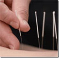 acupuntura curitiba