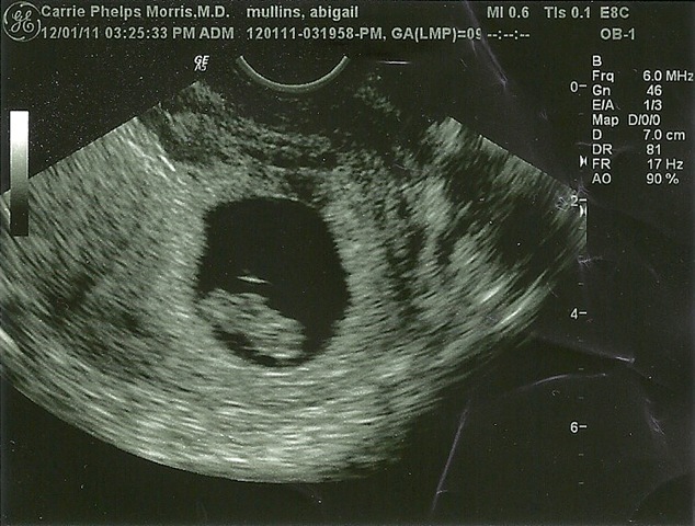 [baby%2520boy%252010003%255B3%255D.jpg]