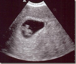 Baby7 is 7wk4d