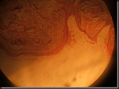 Teratoma high resolution histology slide tsnaps Teratoma high resolution histology slide tsnaps