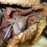 inferior_vena_cava_L.JPG