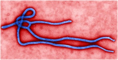 [ebola_virus4.jpg]