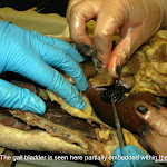 gall_bladder_probe_L.JPG