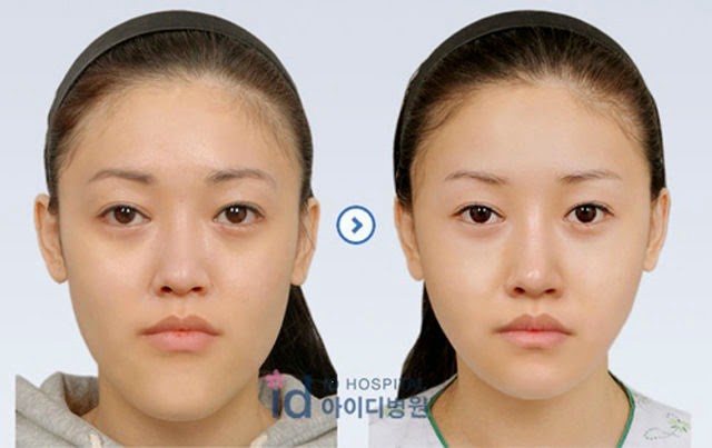 [korean-plastic-surgery-19%255B2%255D.jpg]
